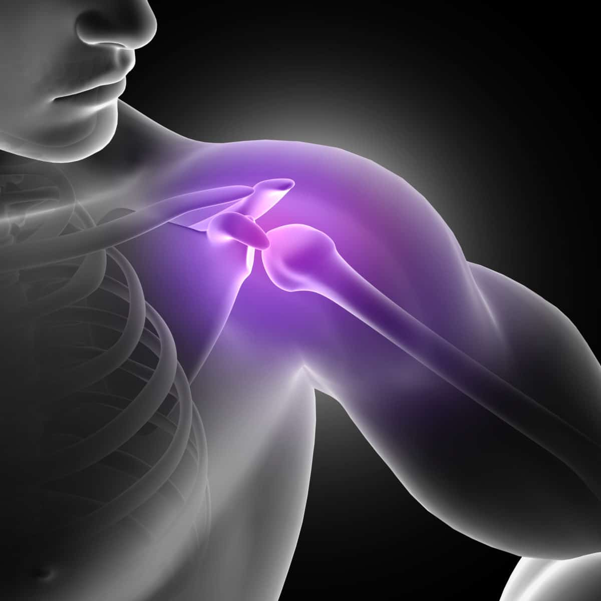 osteolysis and weightlifters shoulder treatment