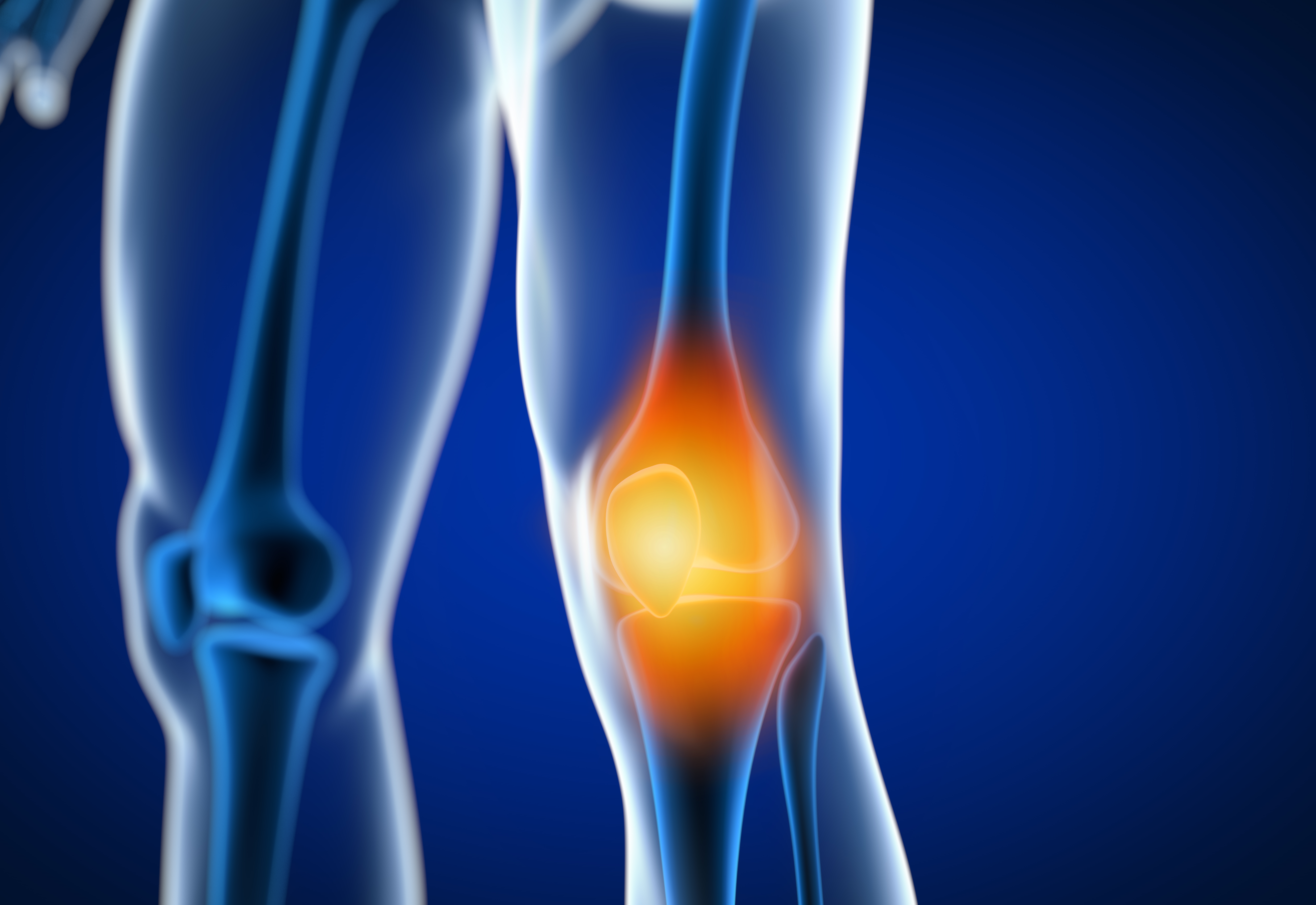 sore knee treatment dallas