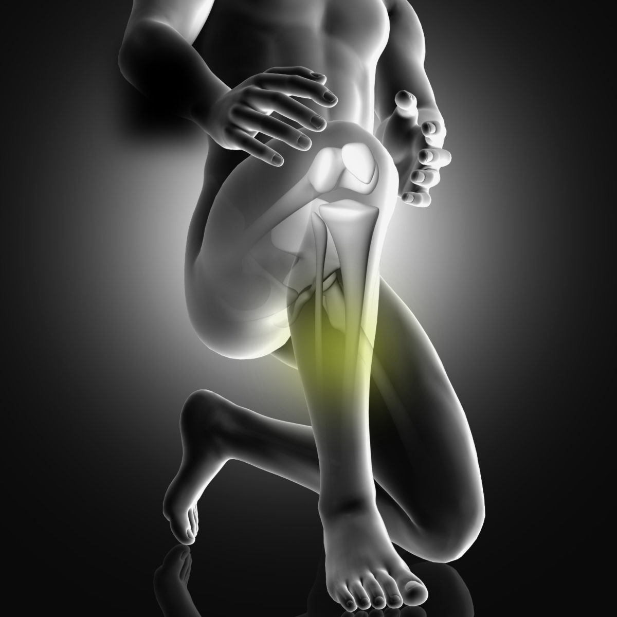 shin splints treatment in dallas and frisco