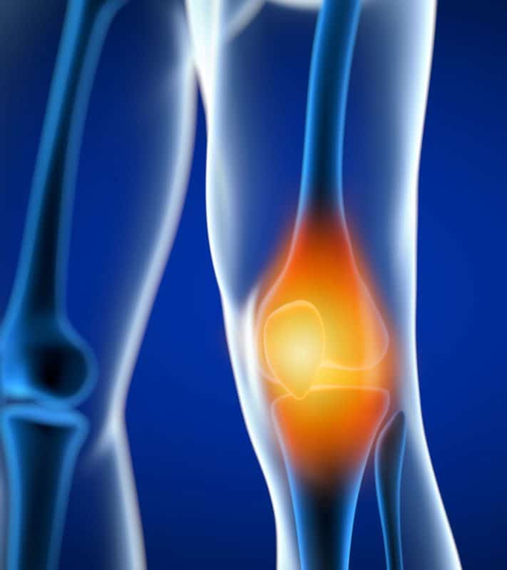 Sore Knee Treatment in Dallas | Knee Specialist | Orthopedic Surgeon