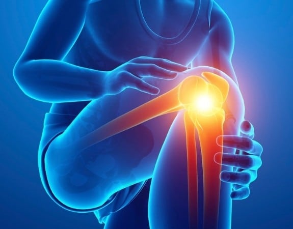 Dallas Knee Arthroscopy | SPORT Orthopedics + Physical Therapy