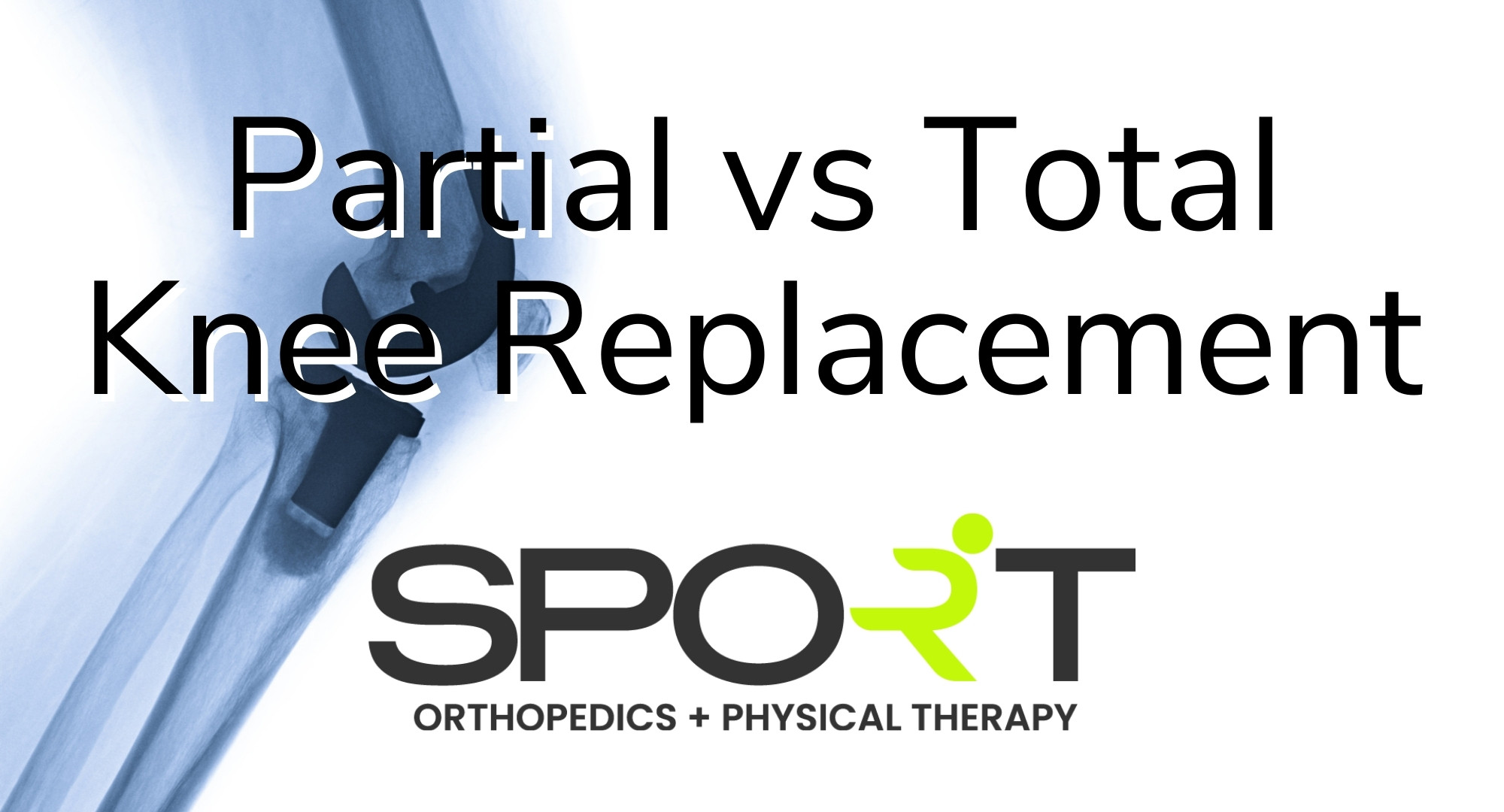Partial Vs Total Knee Replacement Sport Orthopedics Podcast 17