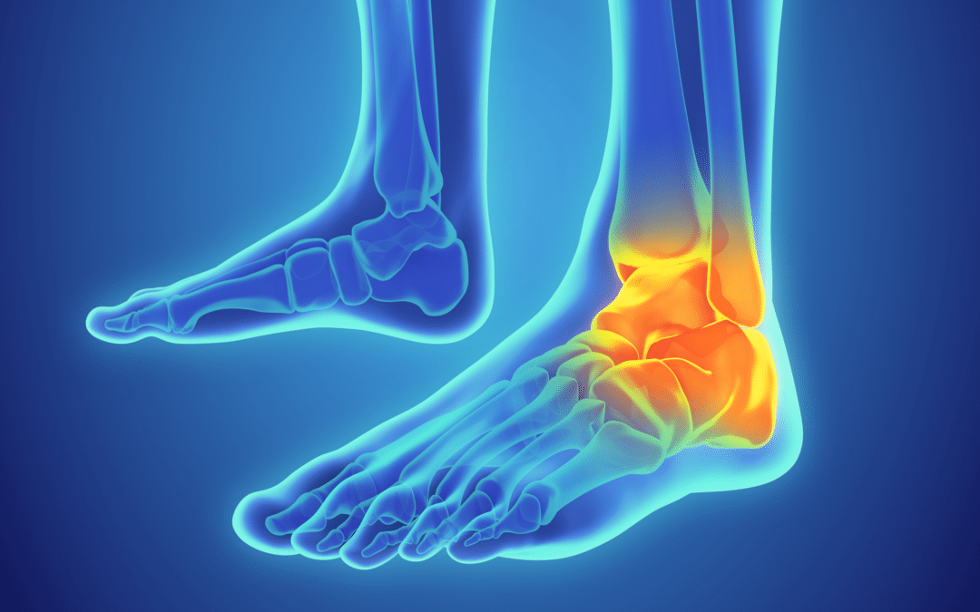 https://sportsmedtexas.com/wp-content/uploads/2021/07/ankle-fracture-treatment.png