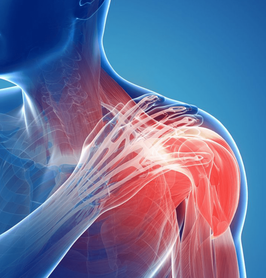 shoulder dislocations