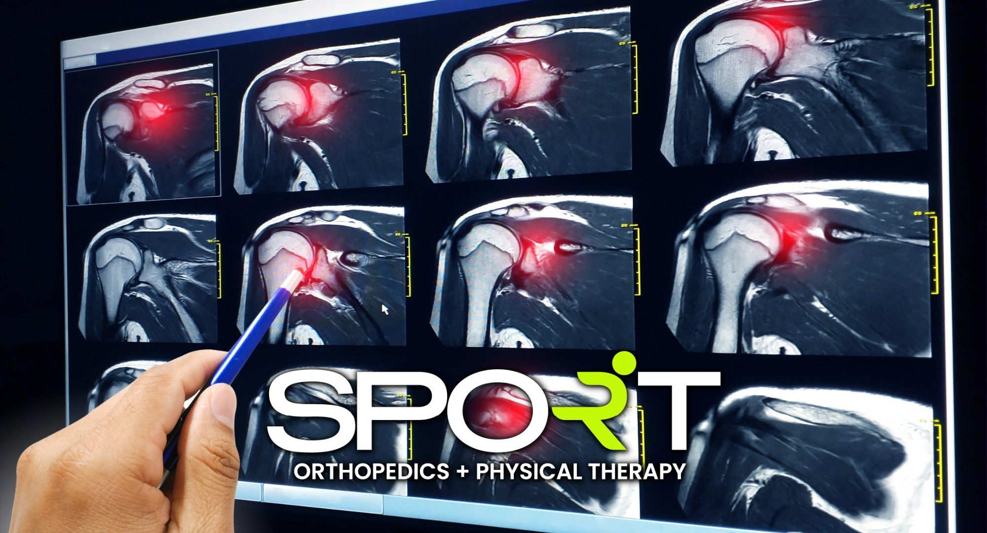 Shoulder Pain  3D Sports Medicine & Orthopaedic Center