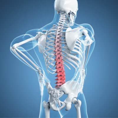 Lumbar Spondylosis Treatment | SPORT Orthopedics | Dallas & Frisco, TX