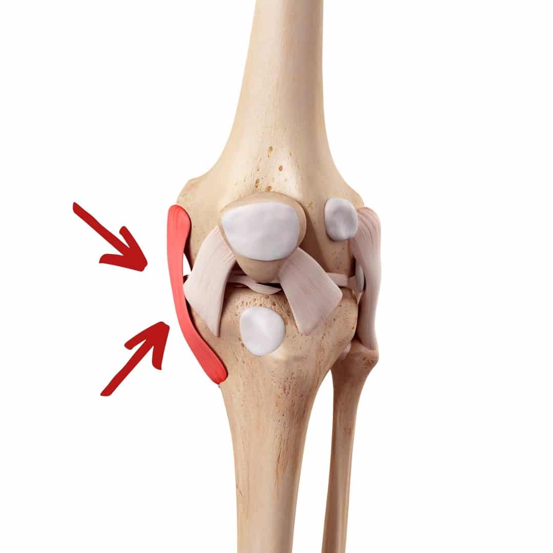 MCL Injury A Common Cause Of Medial Knee Pain