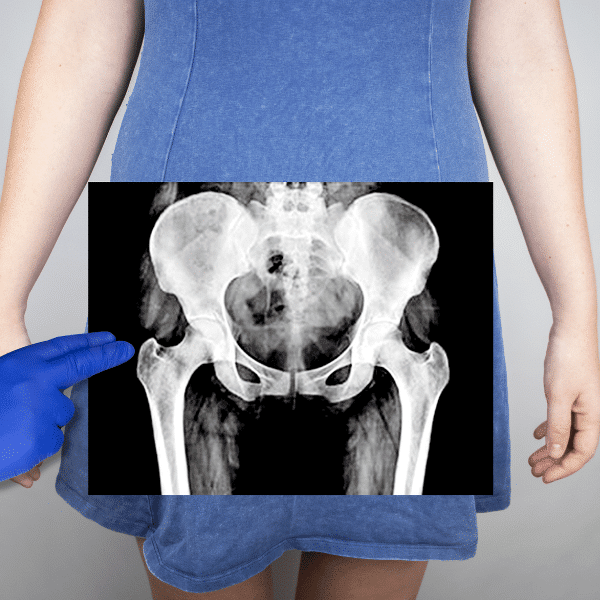 pelvic bone pain treatment in dallas