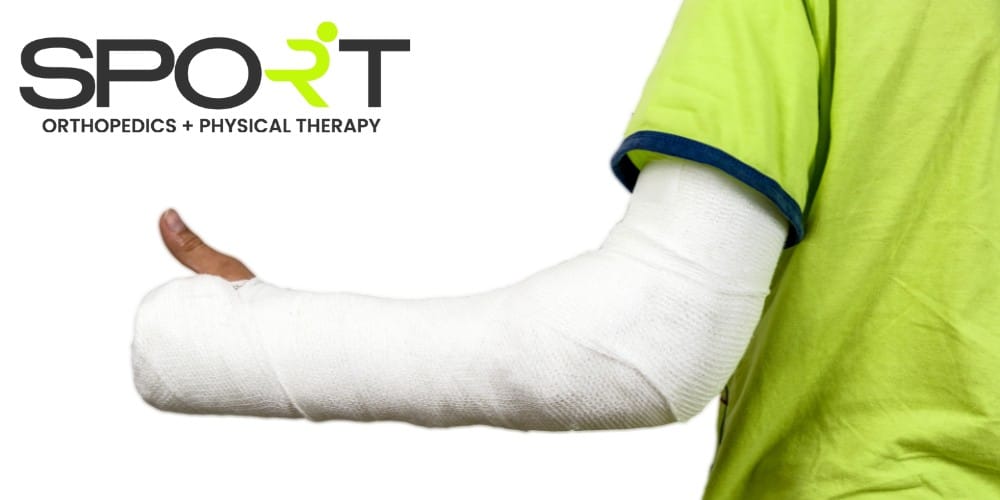 Displaced Fracture Treatment | SPORT Orthopedics | Dallas, TX