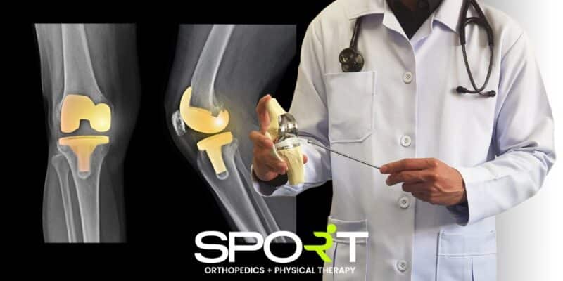 knee joint replacement