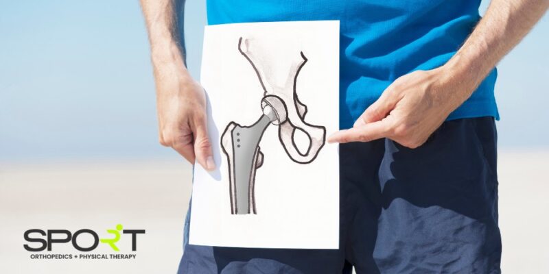 hip replacement surgery dallas