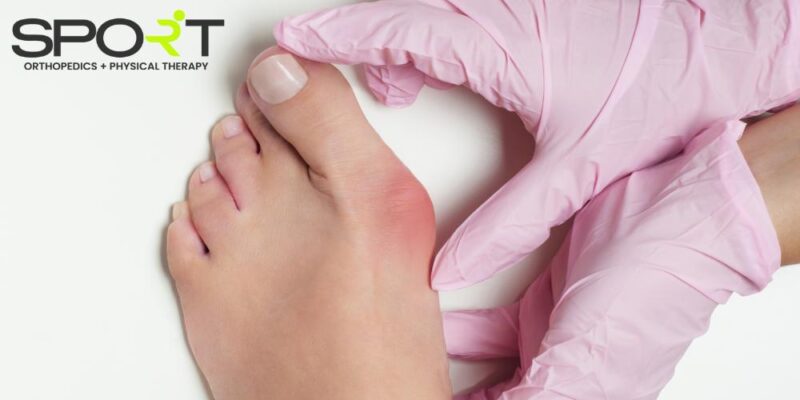 mallet toe treatment dallas