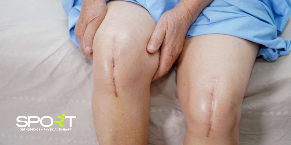 dallas tx knee replacement surgeon