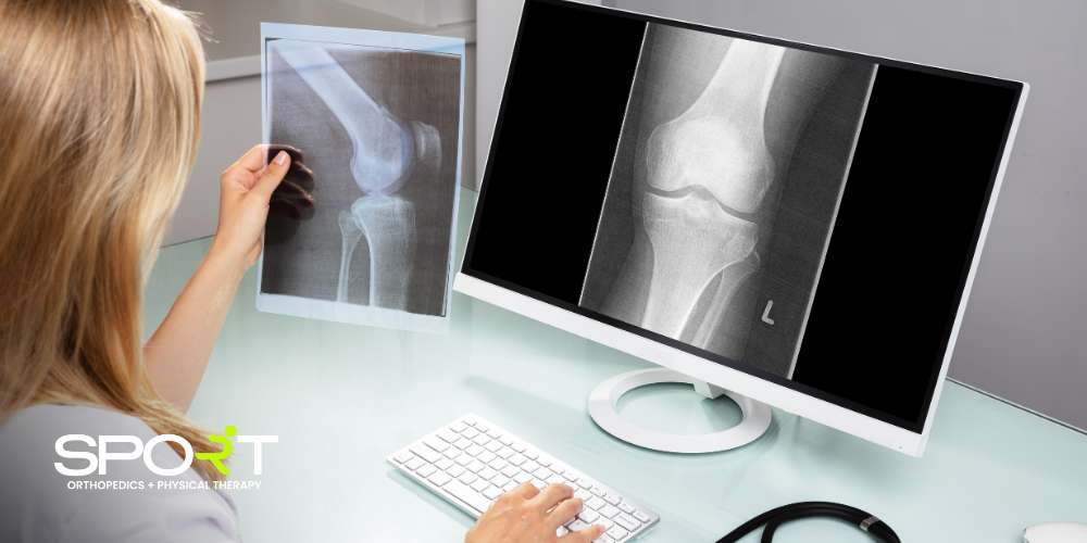 knee replacement surgery in dallas tx