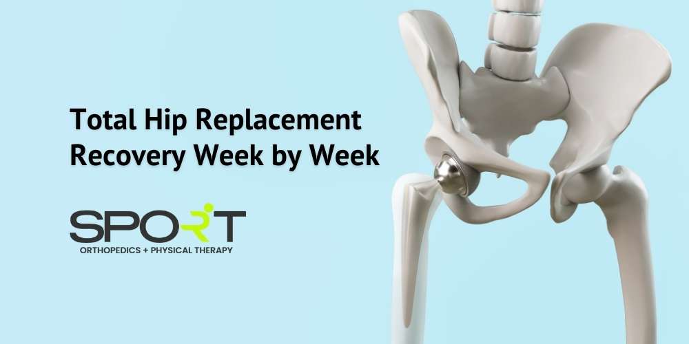 total hip replacement recovery week by week